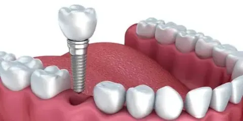 Chứng chỉ chuyên gia Khớp thái dương hàm & Khớp cắn